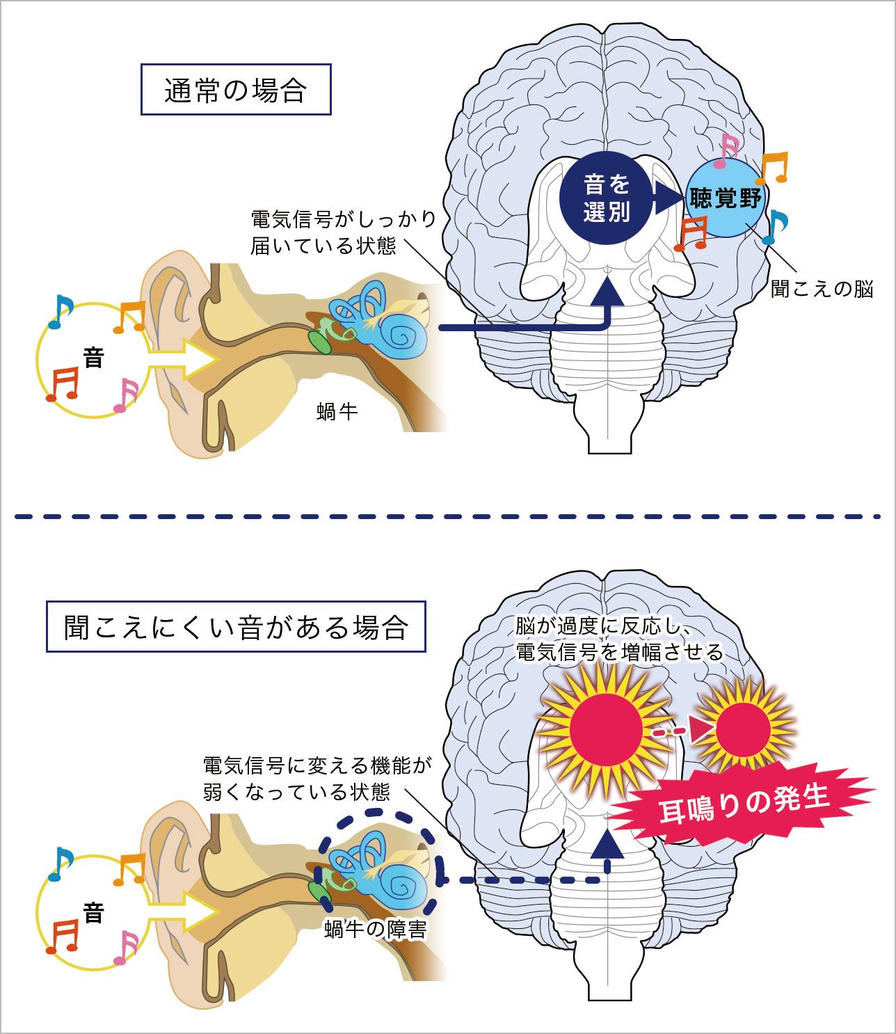 リラクゼーションと瞑想で耳鳴りを軽減する方法